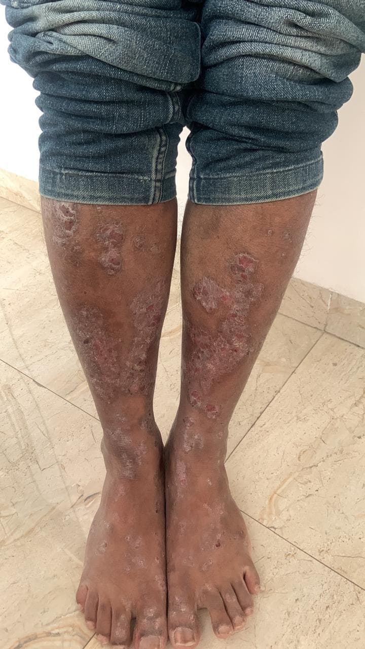 Before treatment